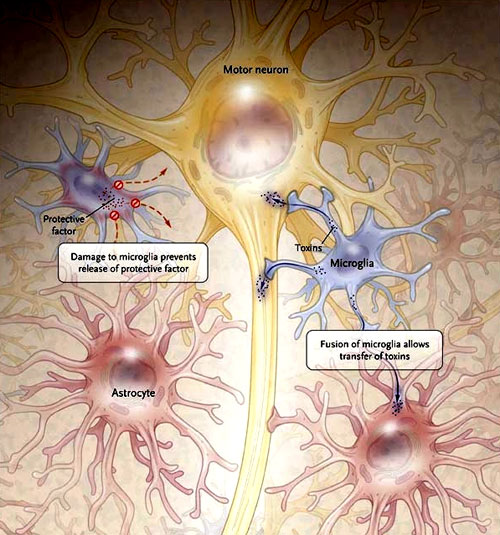 Figura 2: mecanismos potenciales de lesión de las motoneuronas por la microglía