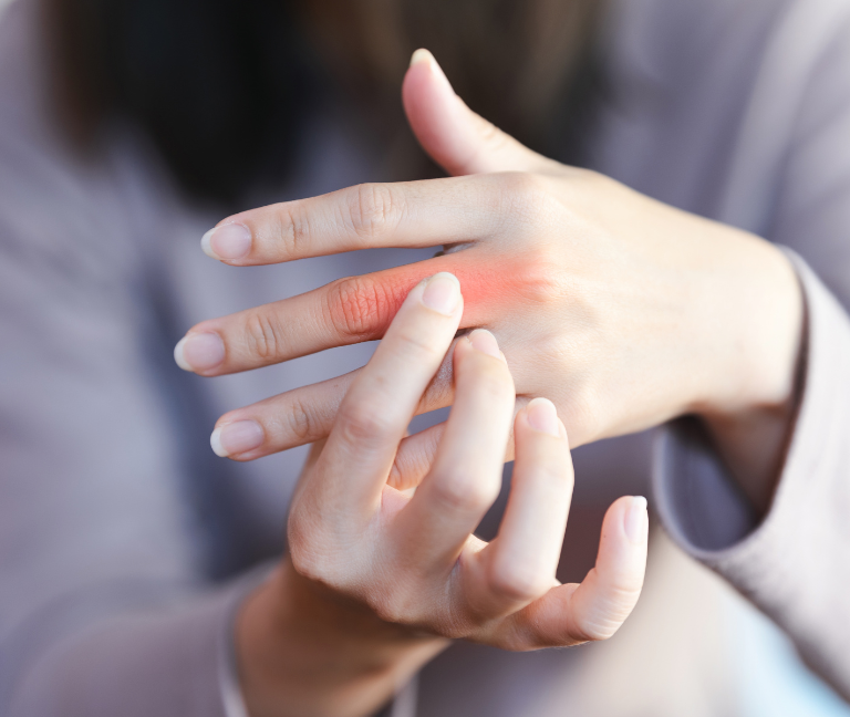 Abordaje de la artritis reumatoide en América Latina