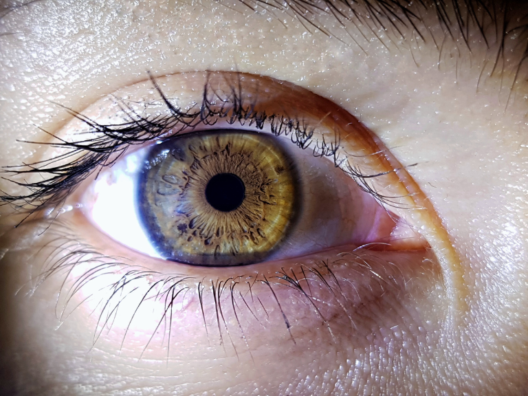 endoftalmitis, simposio oftalmológico, infección intraocular, cirugía ocular, oftalmología Ecuador, Sociedad Nacional de Oftalmología Ecuador, vitrectomía, prevención endoftalmitis, manejo quirúrgico endoftalmitis, retinólogos Ecuador, quirófano oftalmológico, iodopovidona, antibioticoterapia ocular, pérdida de visión, complicaciones cirugía ocular, consenso médico oftalmología, Guayaquil salud visual, instrumentistas quirúrgicos, regulación quirófanos, seguridad quirúrgica
