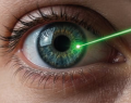 Lago Agrio, Visalud Lago Agrio, Norlase LEAF, tecnología láser para retina, láser retinal, oftalmología, retina, enfermedades retinales, retinopatía diabética, trombosis retiniana, coroidopatía serosa, tratamiento retinal, tecnología oftalmológica, láser de alta precisión, atención oftalmológica, salud visual, Ecuador, Amazonía ecuatoriana