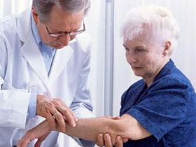 Recurrencia tardía del melanoma se asocia con mejor supervivencia