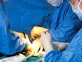 Ligadura de trompas no influye en el cáncer de mama