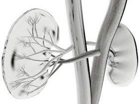 Más hepatitis C oculta en pacientes con nefropatía glomerular