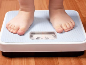 Esclerosis múltiple es prevalente en jóvenes con obesidad