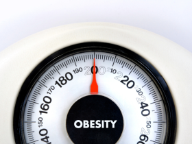 obesidad, adiposidad, nueva definición de obesidad, índice de masa corporal, obesidad solo antropométrica, obesidad clínica, obesidad preclínica