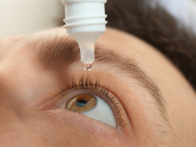 enfermedad del ojo seco, queratoconjuntivitis seca, pacientes diabéticos, diabetes mellitus, diabetes, diabetes tipo 2, ojo seco