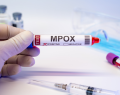 mpox, virus mpox, viruela del mono, orthopoxvirus