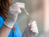virus del papiloma humano, VPH, cribado del VPH, detección del VPH, autotoma de muestra vaginal, cáncer cervicouterino, tamizaje de cáncer cervicouterino