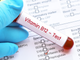 deficiencia de vitamina B12, hipovitaminosis B12, neuropatía periférica, metformina, uso crónico de metformina, uso de metformina a largo plazo, diabetes tipo 2