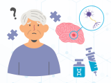 enfermedad de Alzheimer, alzheimer, donanemab