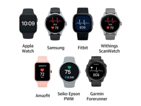 fibrilación auricular, arritmia, accidentes cerebrovasculares, enfermedades cardíacas, smartwatches