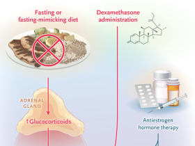 ayuno en cáncer, cáncer de mama, cáncer de mama con receptor de estrógeno positivo, terapia hormonal, tamoxifeno, tumores sensibles a esteroides