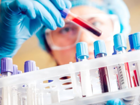 Clínica Mayo, Mayo Clinic, cáncer testicular, detección de cáncer testicular, diagnóstico de cáncer testicular, marcadores tumorales, análisis de sangre, tumores de células germinales, GCT-iSIGN, Sem-iSIGN, biomarcadores sanguíneos, sistema inmunitario, detección temprana del cáncer, diagnóstico precoz, investigación médica, estudio científico, oncología, cáncer en adolescentes, cáncer en adultos jóvenes, pruebas diagnósticas, medicina de precisión, diagnóstico oncológico, tratamiento del cáncer testicular, Divyanshu Dubey, Dr. Divyanshu Dubey, profesor de neurología, investigación en cáncer, biomarcadores inmunológicos, innovación médica, salud masculina, tumores testiculares, detección temprana, avances en oncología, medicina traslacional